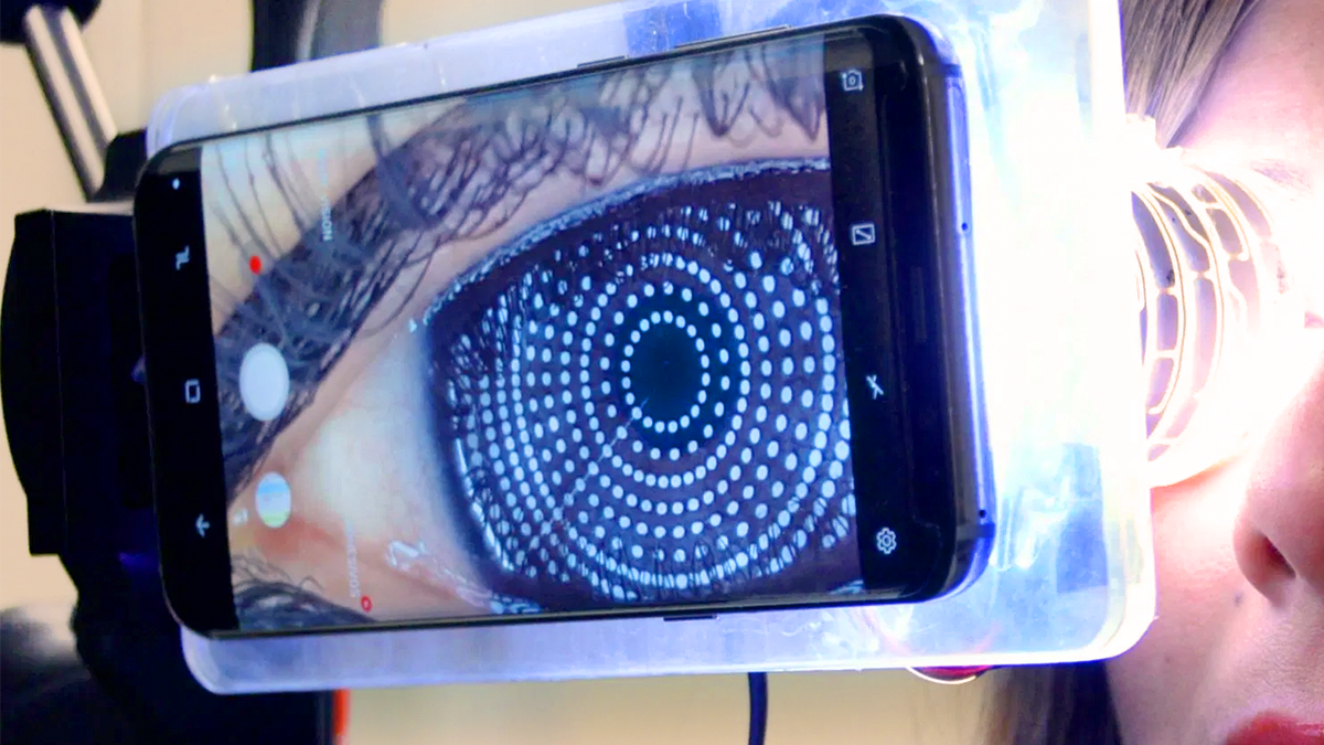 Profesor de la UNAM diseña un topógrafo corneal con cámara de celular - 330ohms